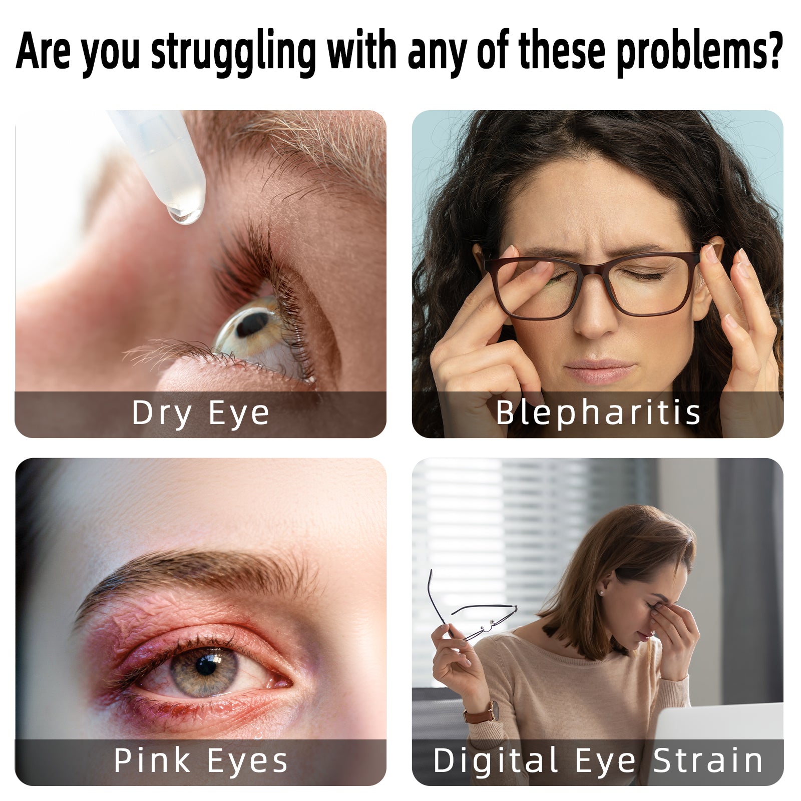 Fismool Sleep Mask 2.0 - Black, ideal for dry eyes, blepharitis, and digital eye strain relief during sleep.